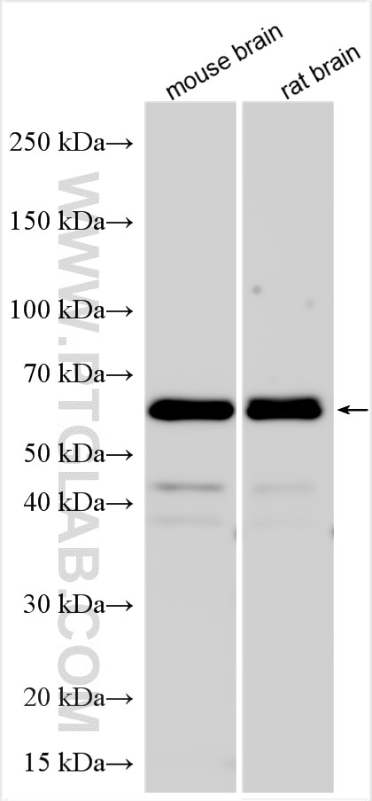 Western Blot (WB) analysis of mouse brain tissue using TOM1L2 Polyclonal antibody (32179-1-AP)