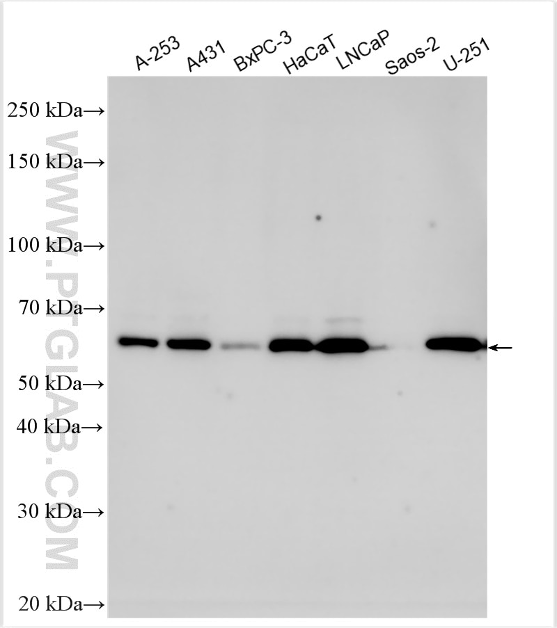 Western Blot (WB) analysis of various lysates using TOM1L2 Polyclonal antibody (32179-1-AP)