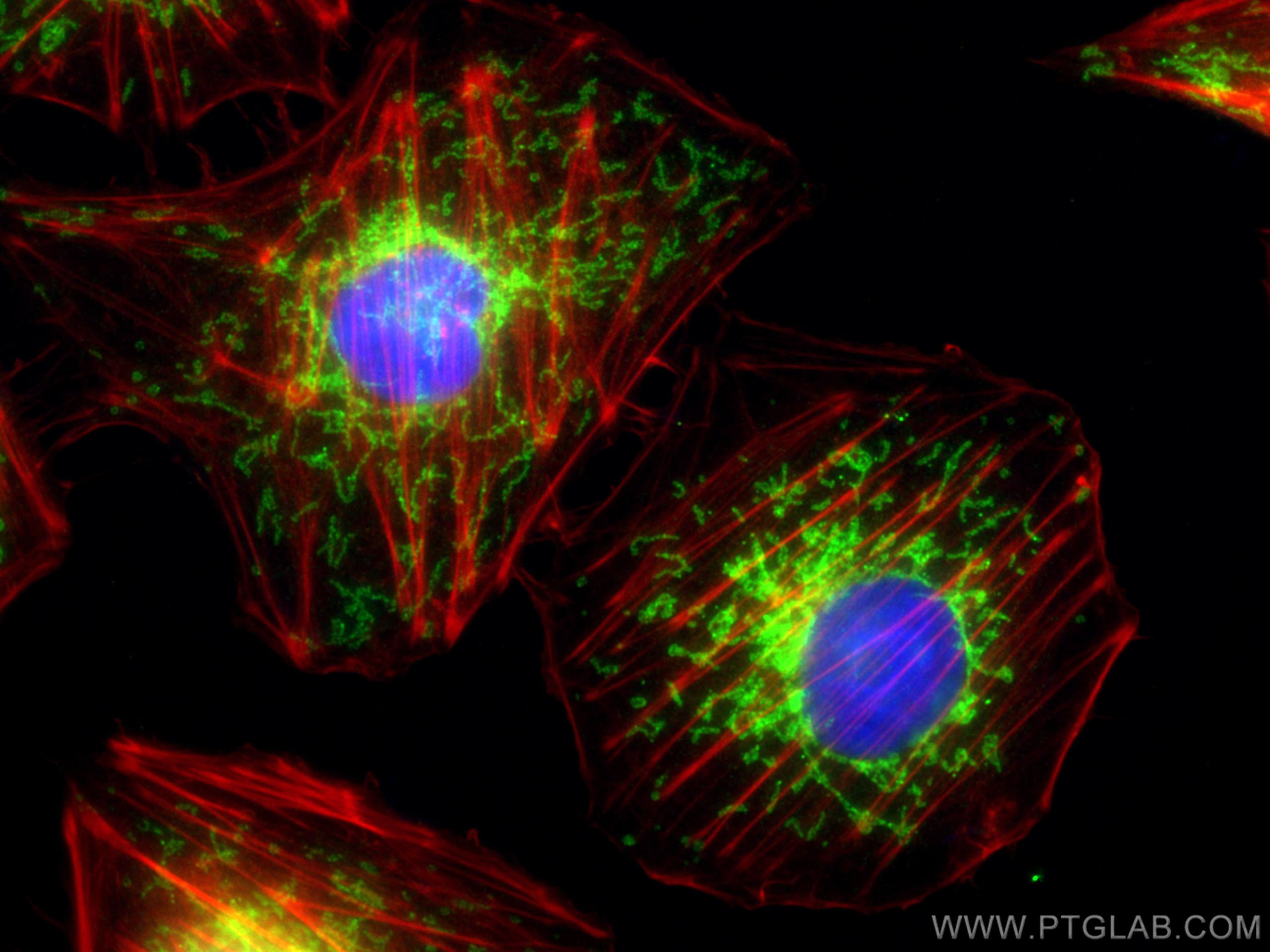 Immunofluorescence (IF) / fluorescent staining of HUVEC cells using TOM20 Polyclonal antibody (11802-1-AP)