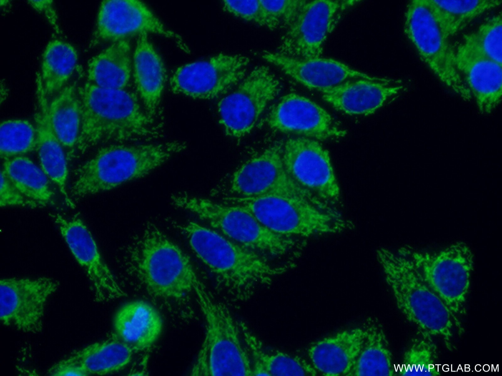 TOM20 Polyclonal antibody