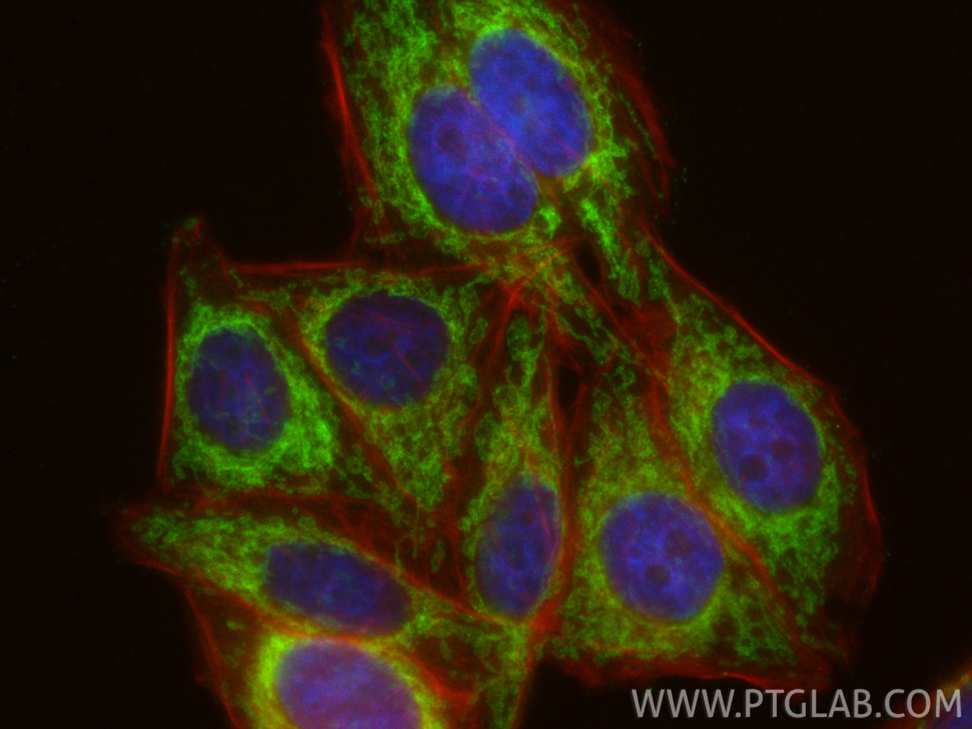 IF Staining of HepG2 using 11802-1-AP Immunofluorescence (IF) / fluorescent staining of HepG2 cells using TOM20 Polyclonal antibody (11802-1-AP)