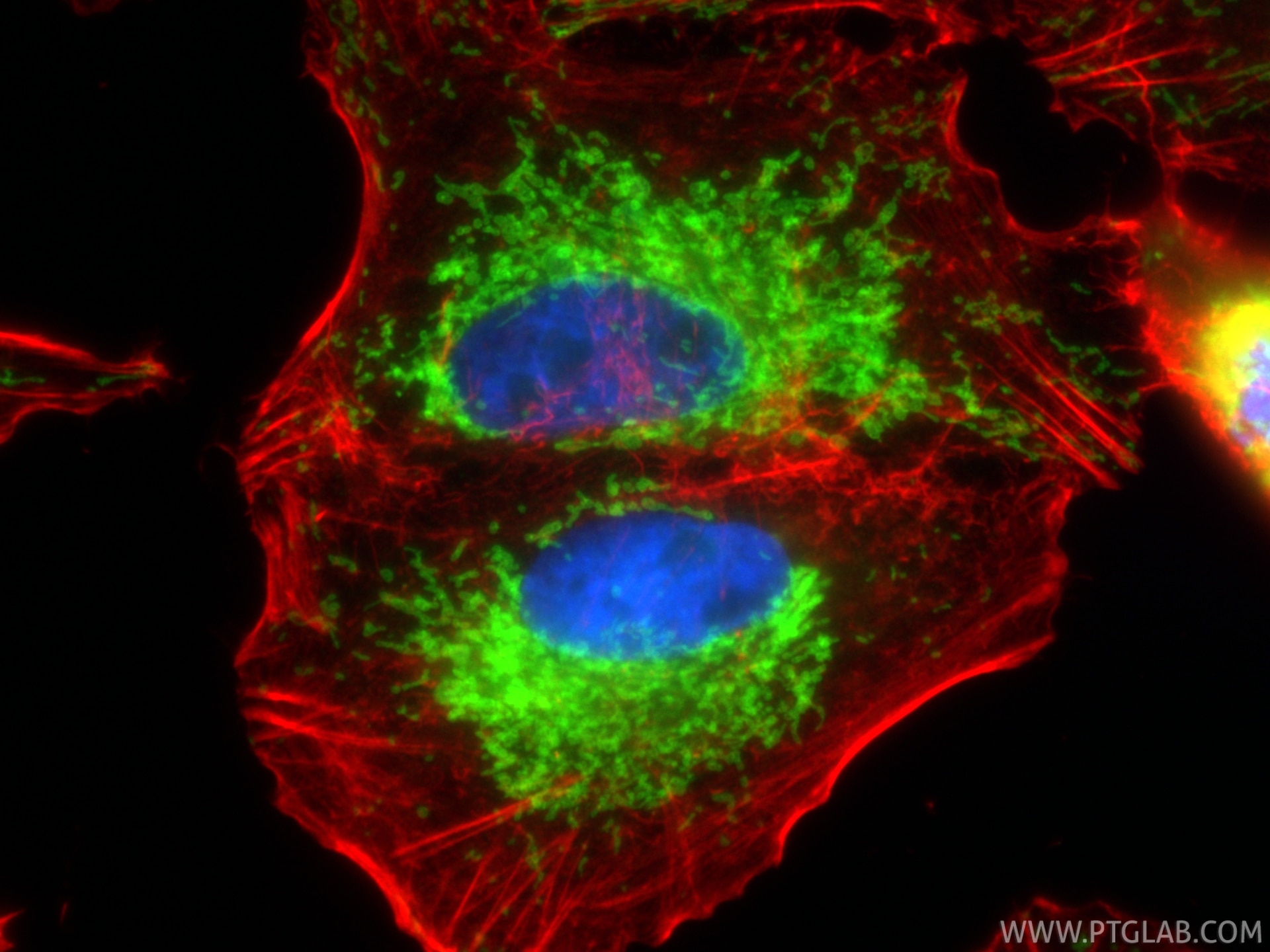 IF Staining of A549 using 11802-1-AP Immunofluorescence (IF) / fluorescent staining of A549 cells using TOM20 Polyclonal antibody (11802-1-AP)