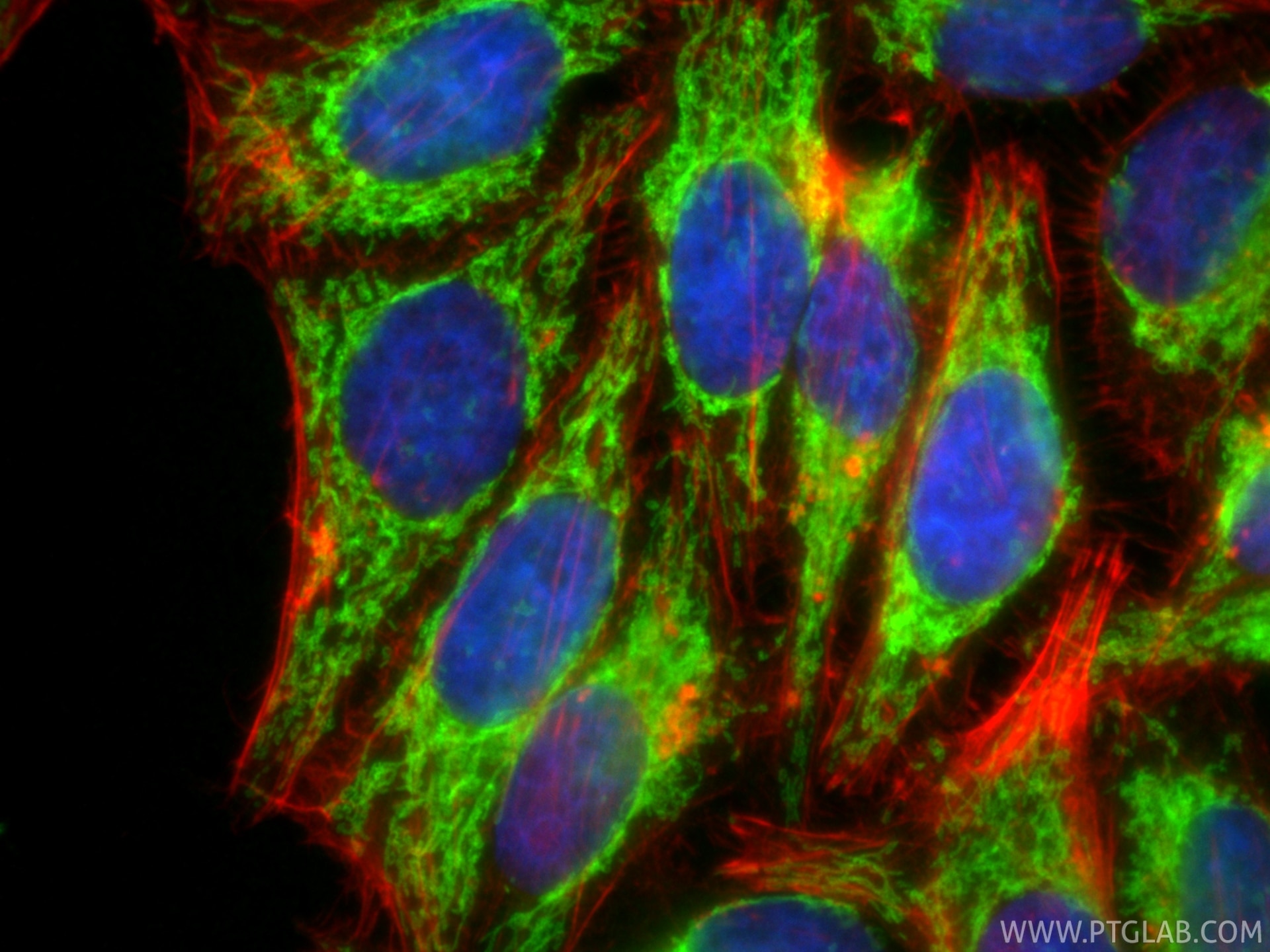 IF Staining of HepG2 using 11802-1-AP Immunofluorescence (IF) / fluorescent staining of HepG2 cells using TOM20 Polyclonal antibody (11802-1-AP)