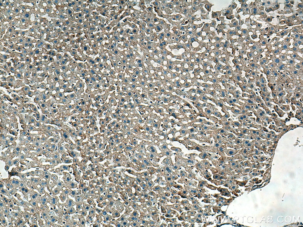 Immunohistochemistry (IHC) staining of mouse liver tissue using TOM20 Polyclonal antibody (11802-1-AP)