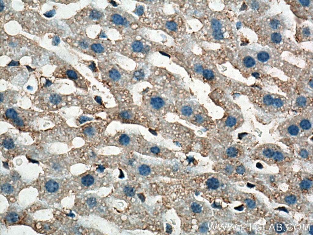 Immunohistochemistry (IHC) staining of mouse liver tissue using TOM20 Polyclonal antibody (11802-1-AP)