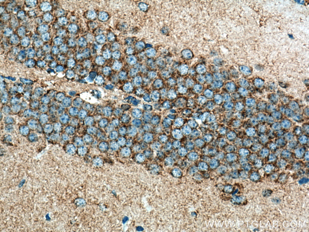 Immunohistochemistry (IHC) staining of mouse brain tissue using TOM20 Polyclonal antibody (11802-1-AP)