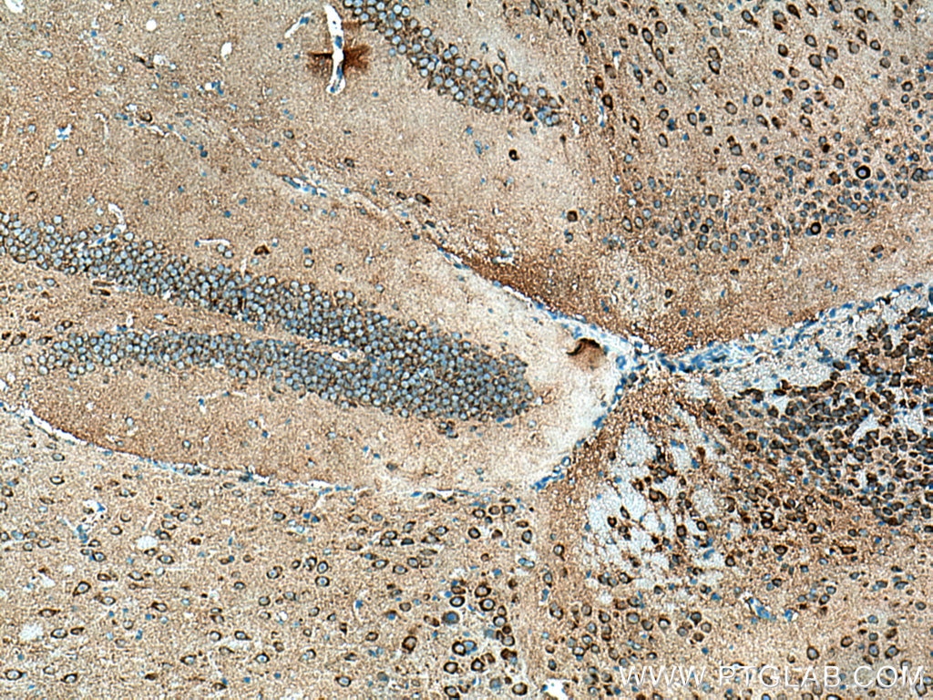 Immunohistochemistry (IHC) staining of mouse brain tissue using TOM20 Polyclonal antibody (11802-1-AP)