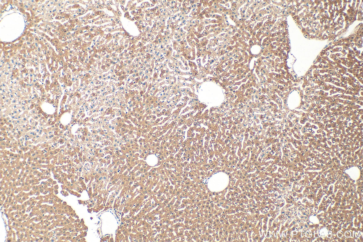 Immunohistochemistry (IHC) staining of mouse liver tissue using TOM20 Polyclonal antibody (11802-1-AP)