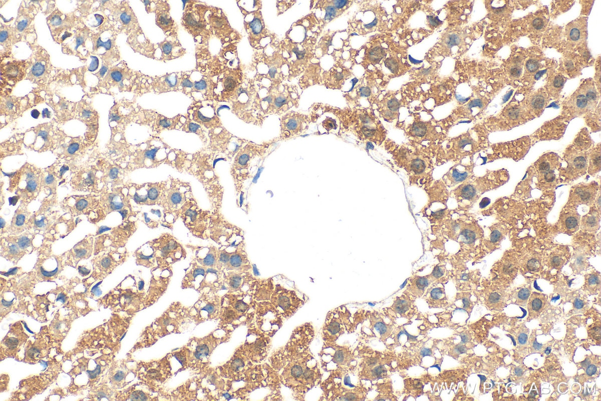 Immunohistochemistry (IHC) staining of mouse liver tissue using TOM20 Polyclonal antibody (11802-1-AP)