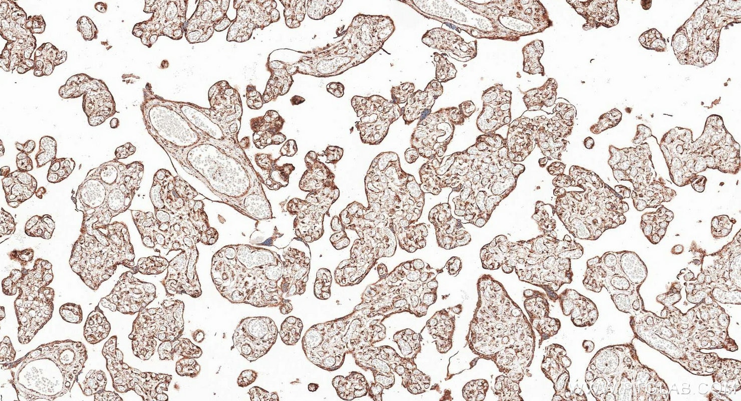 Immunohistochemistry (IHC) staining of human placenta tissue using TOM20 Polyclonal antibody (11802-1-AP)