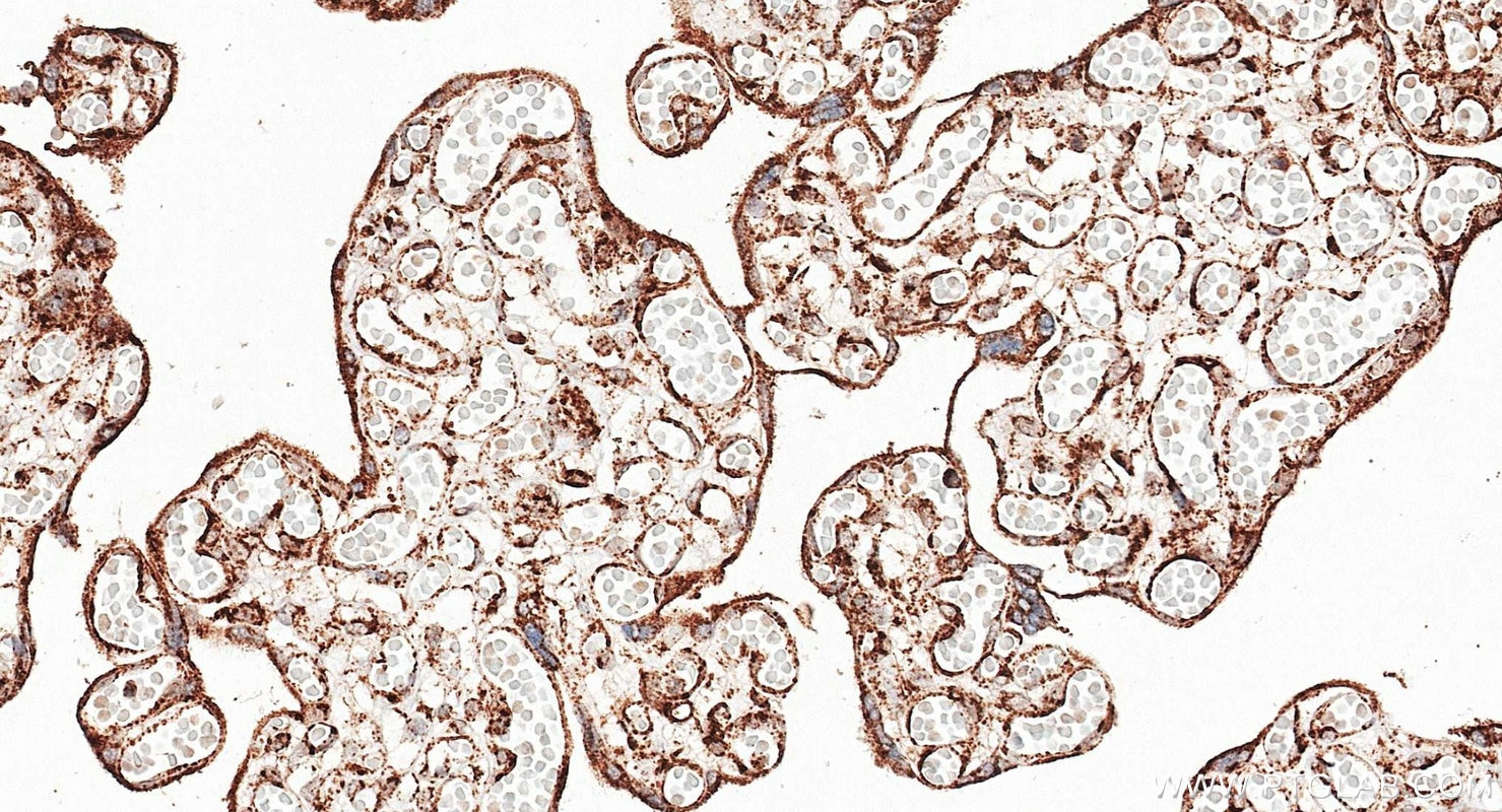 Immunohistochemistry (IHC) staining of human placenta tissue using TOM20 Polyclonal antibody (11802-1-AP)