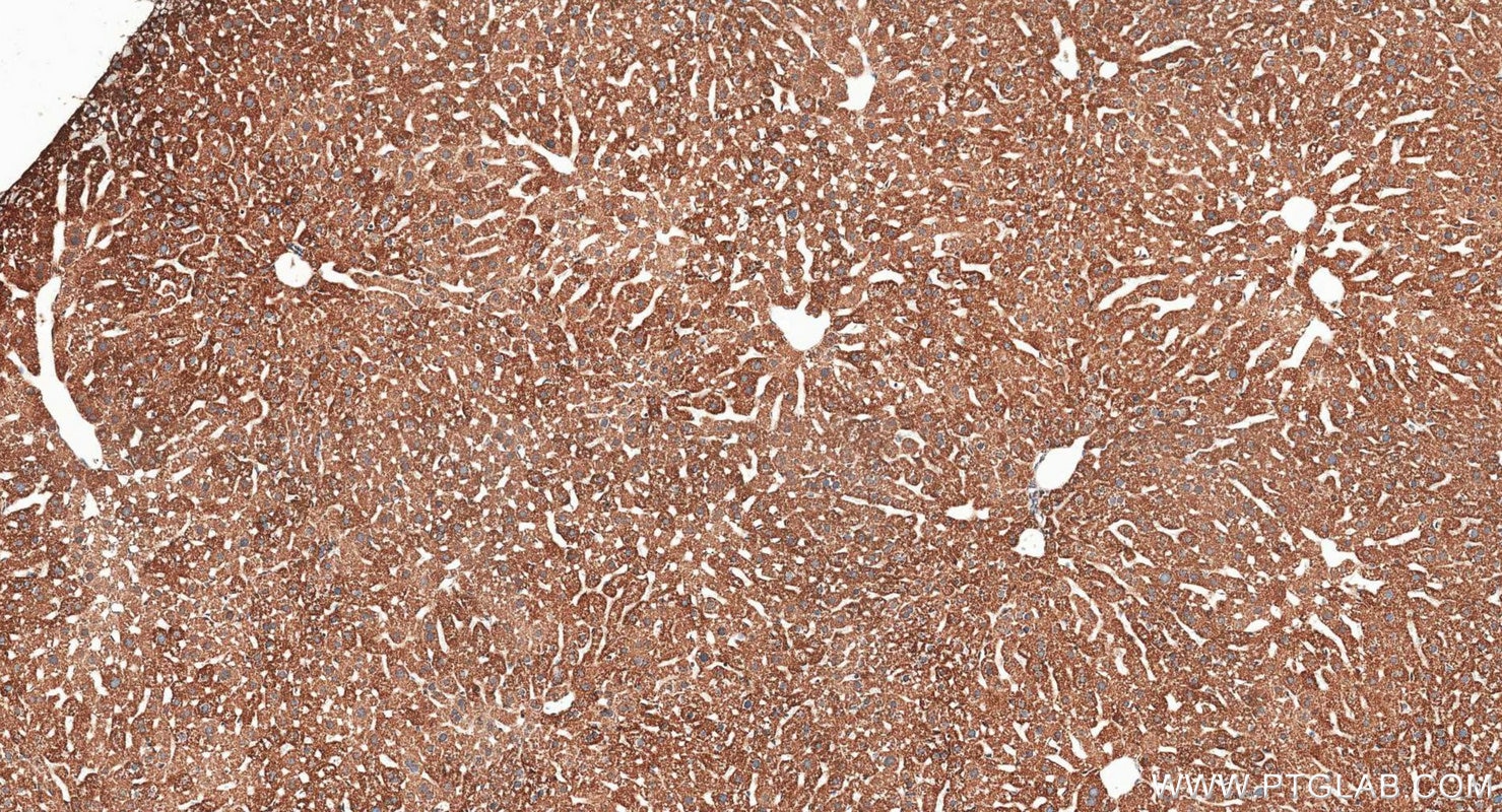 Immunohistochemistry (IHC) staining of mouse liver tissue using TOM20 Polyclonal antibody (11802-1-AP)