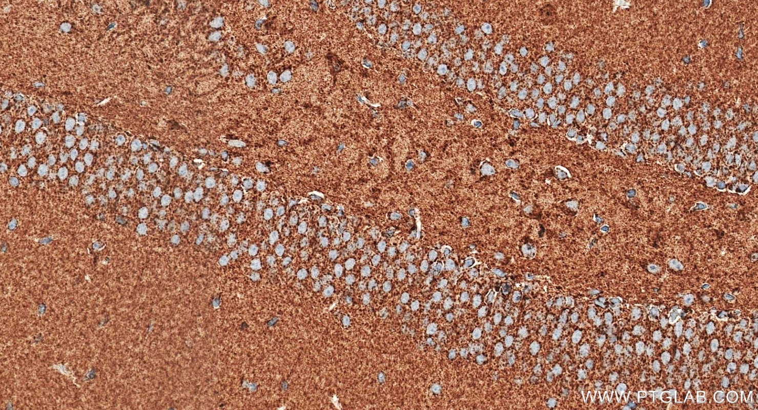 Immunohistochemistry (IHC) staining of mouse brain tissue using TOM20 Polyclonal antibody (11802-1-AP)