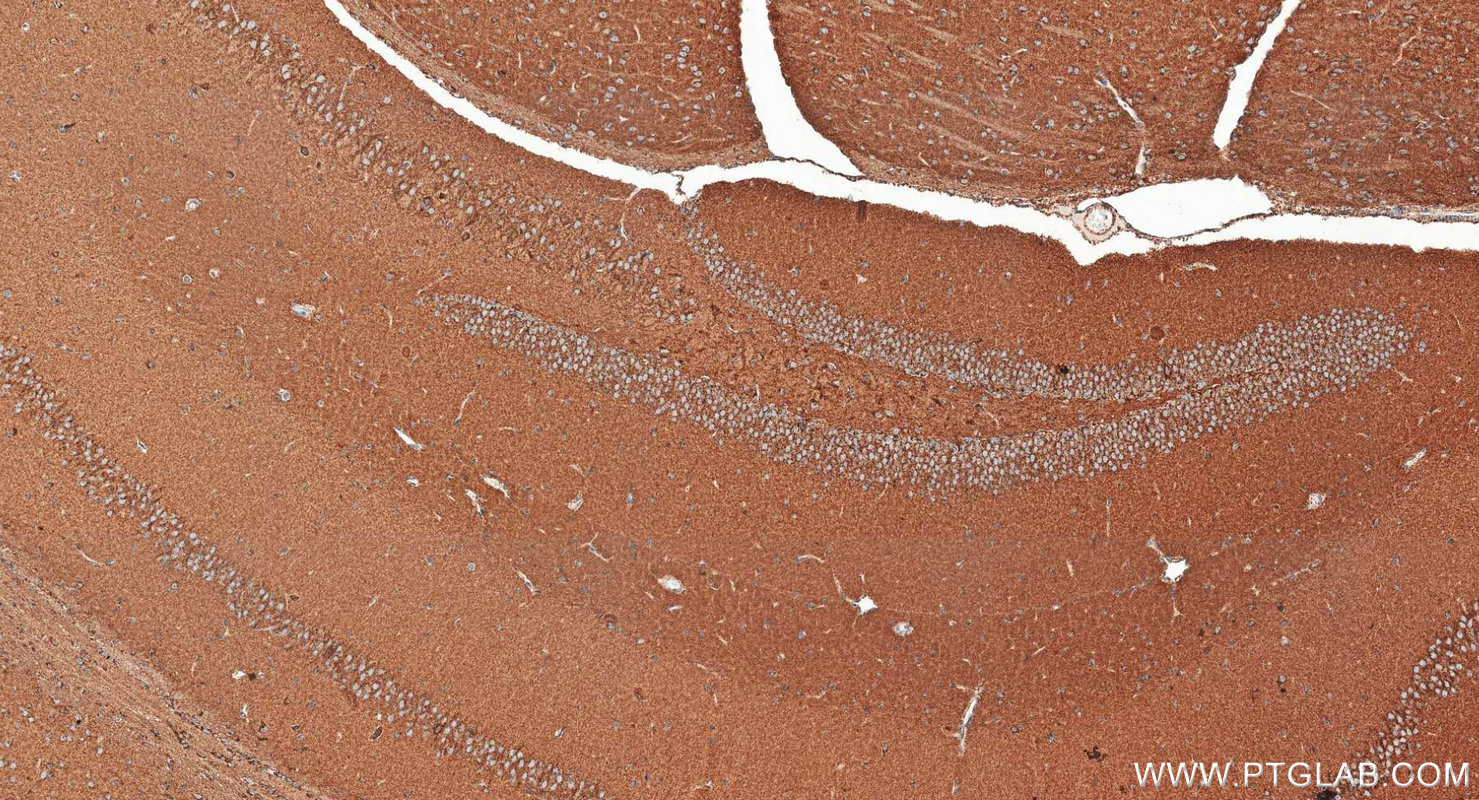 Immunohistochemistry (IHC) staining of mouse brain tissue using TOM20 Polyclonal antibody (11802-1-AP)