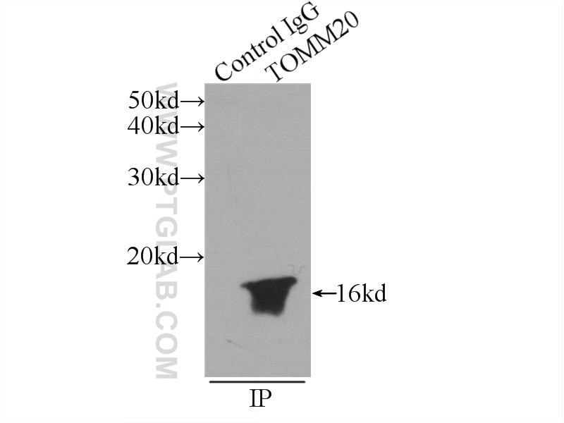 Immunoprecipitation (IP) experiment of HEK-293 cells using TOM20 Polyclonal antibody (11802-1-AP)