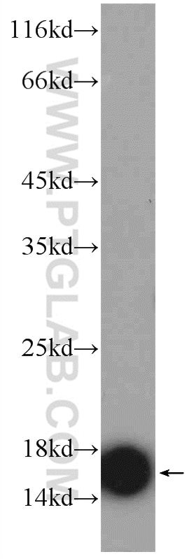 TOM20 Polyclonal antibody