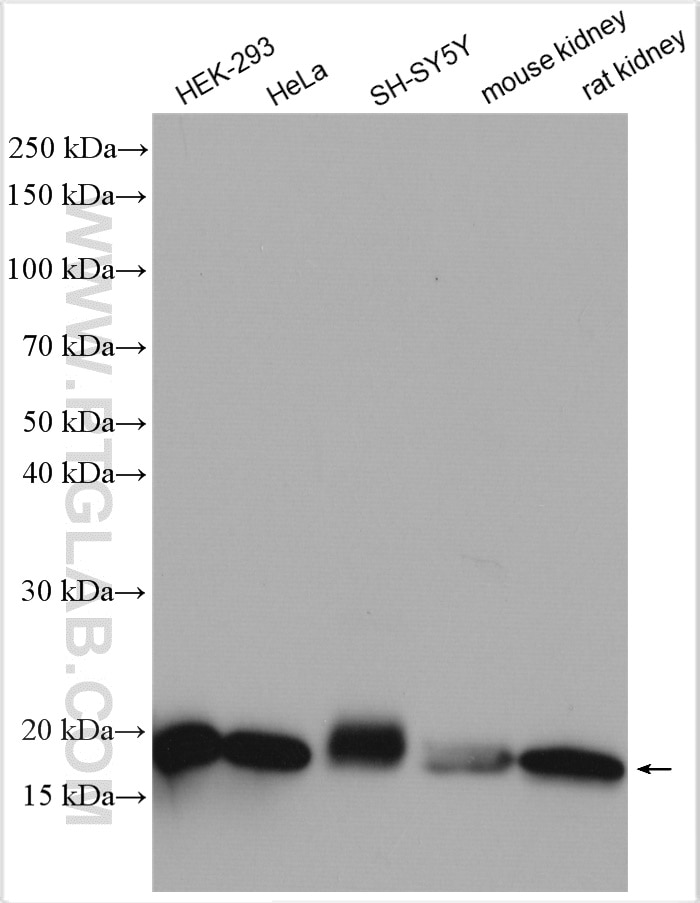 Western Blot (WB) analysis of various lysates using TOM20 Polyclonal antibody (11802-1-AP)