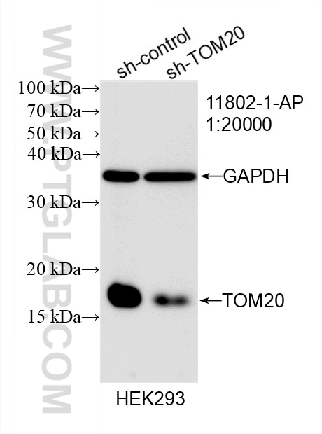 Western Blot (WB) analysis of HEK-293 cells using TOM20 Polyclonal antibody (11802-1-AP)