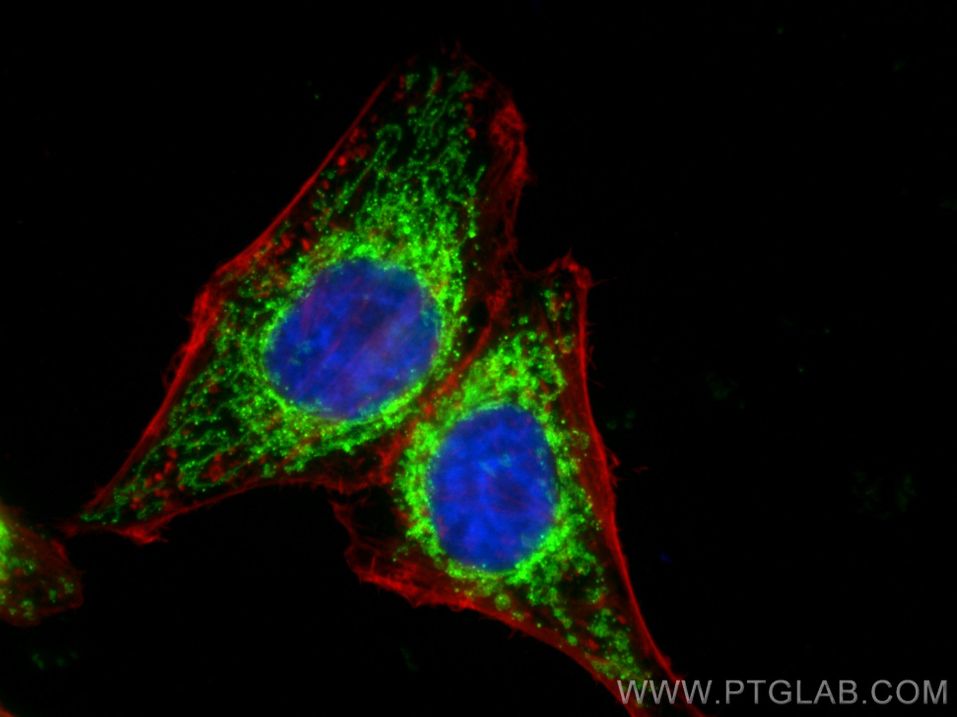 Immunofluorescence (IF) / fluorescent staining of HepG2 cells using TOM20 Recombinant antibody (80501-1-RR)