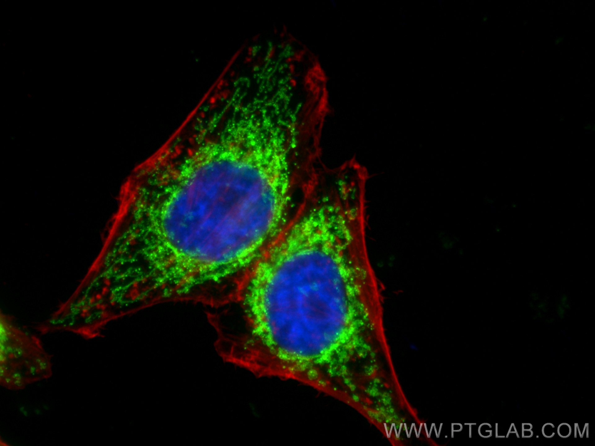 IF Staining of HepG2 using 80501-1-RR