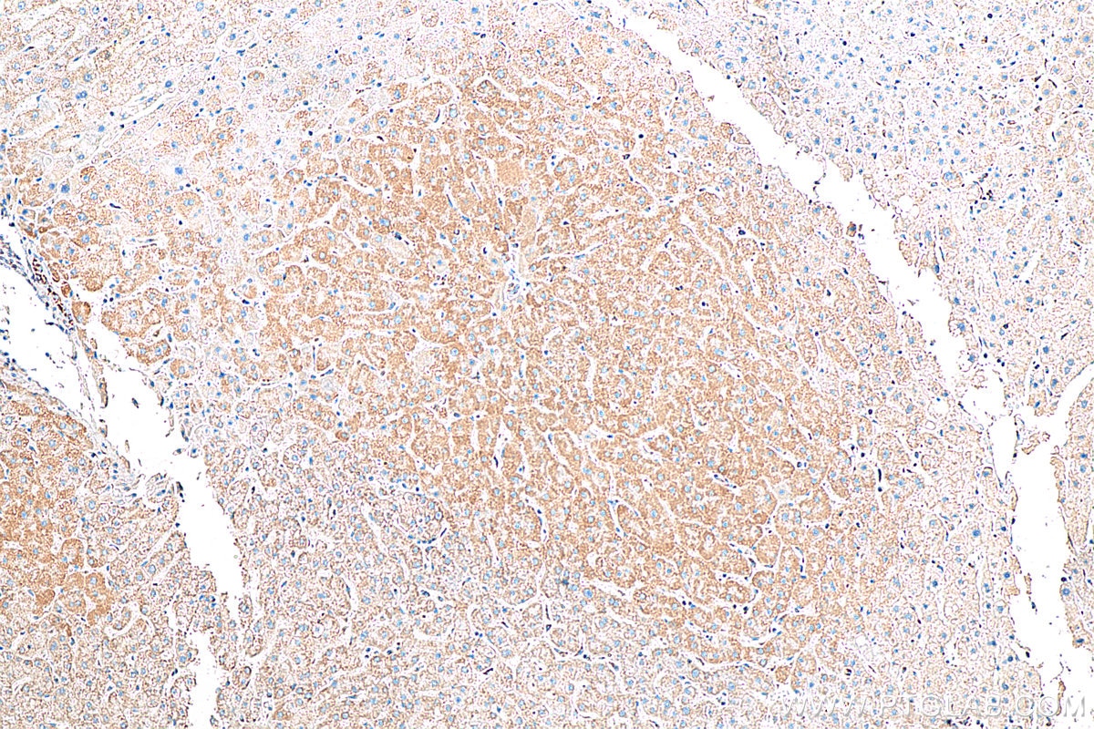 Immunohistochemistry (IHC) staining of human liver tissue using TOM20 Recombinant antibody (80501-1-RR)