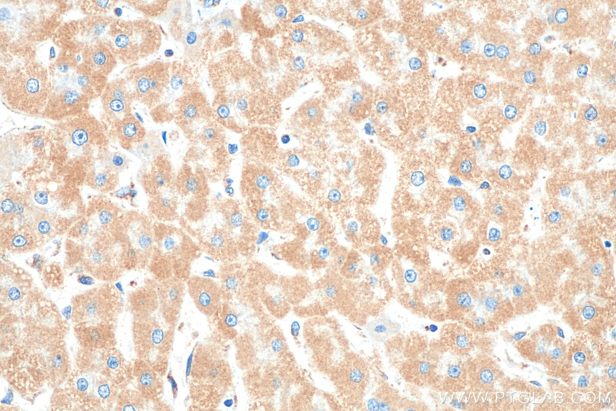 Immunohistochemistry (IHC) staining of human liver tissue using TOM20 Recombinant antibody (80501-1-RR)