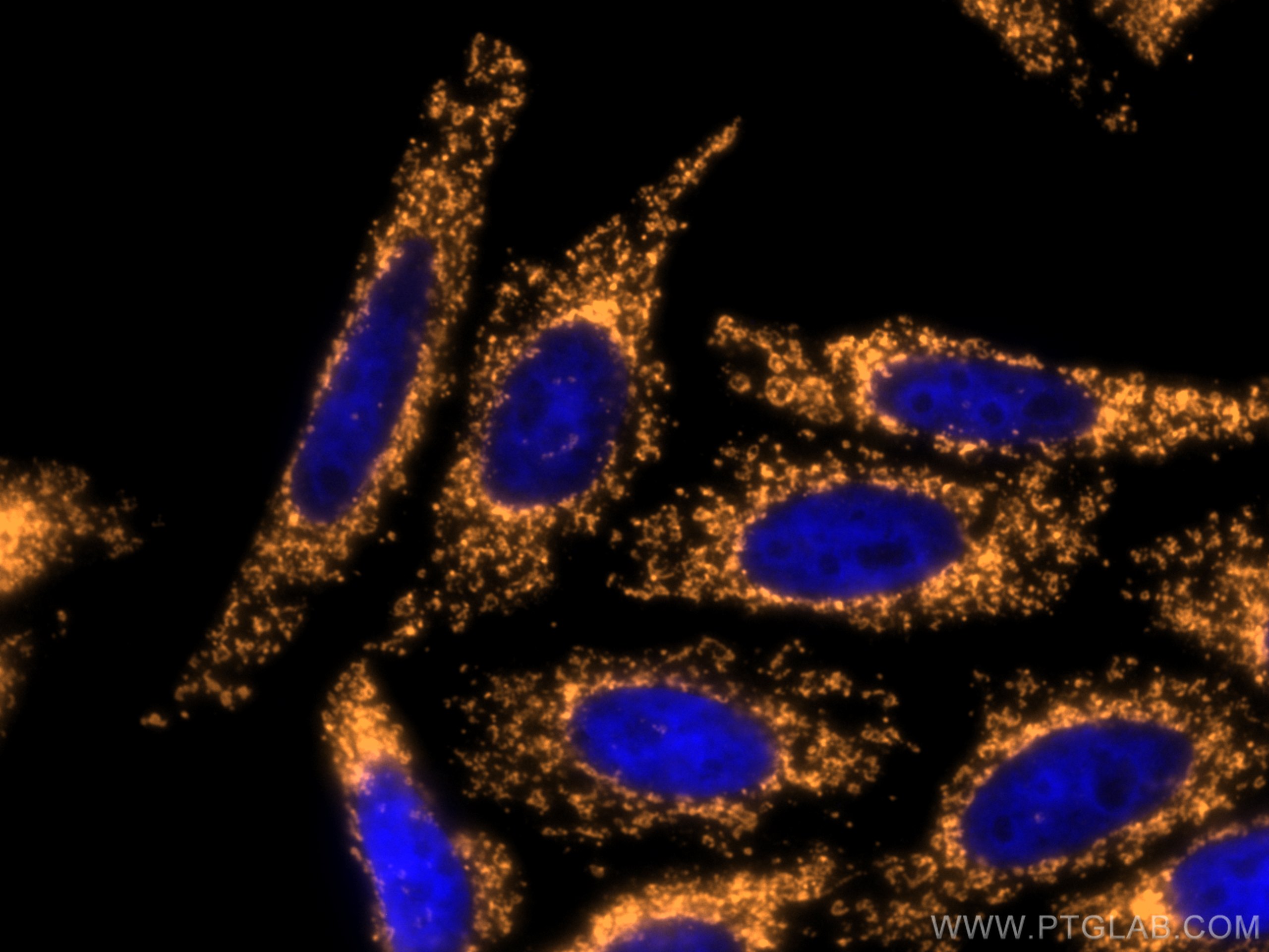 Immunofluorescence (IF) / fluorescent staining of HepG2 cells using CoraLite®555-conjugated TOM20 Polyclonal antibody (CL555-11802)