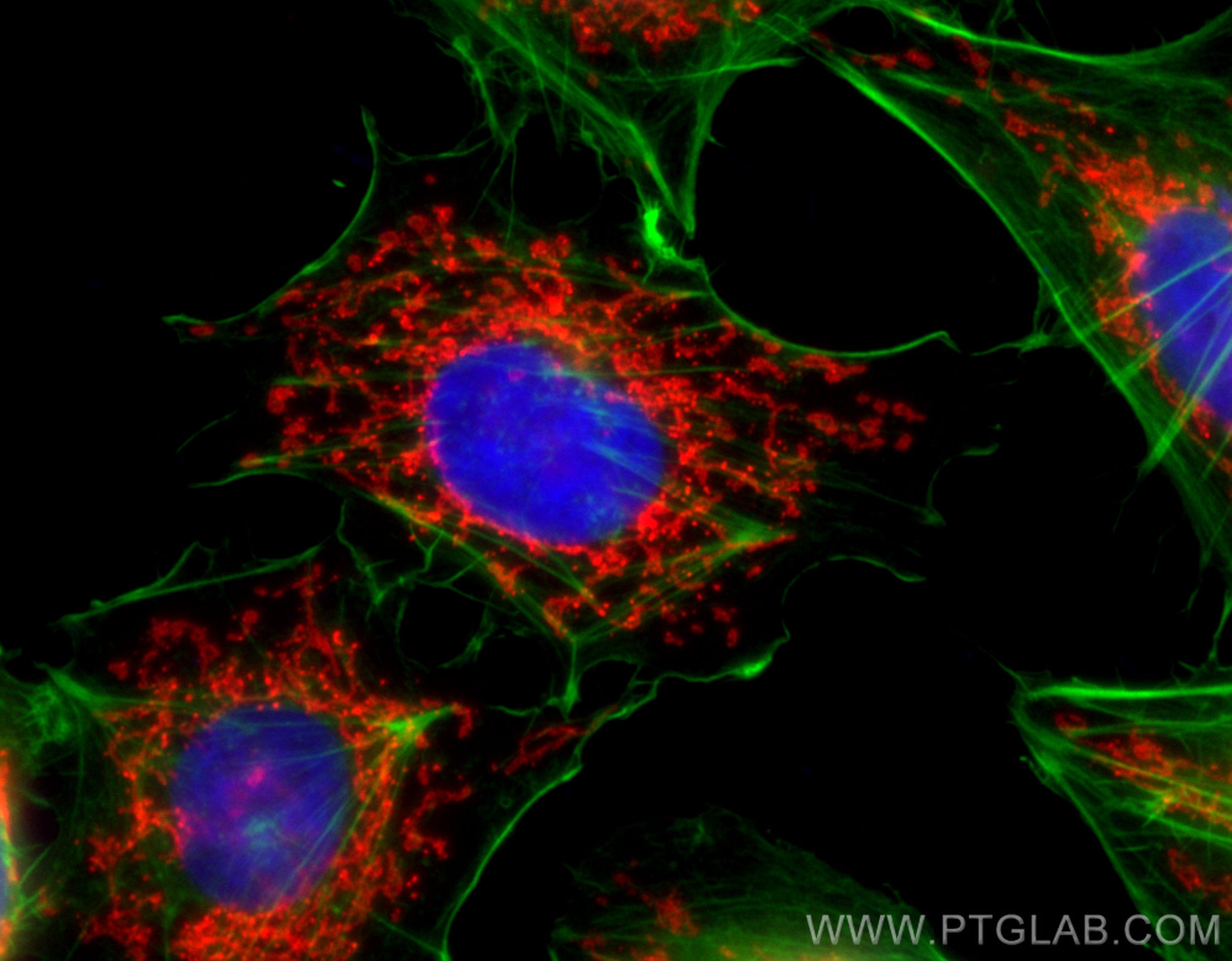 Immunofluorescence (IF) / fluorescent staining of HUVEC cells using CoraLite®594-conjugated TOM20 Polyclonal antibody (CL594-11802)