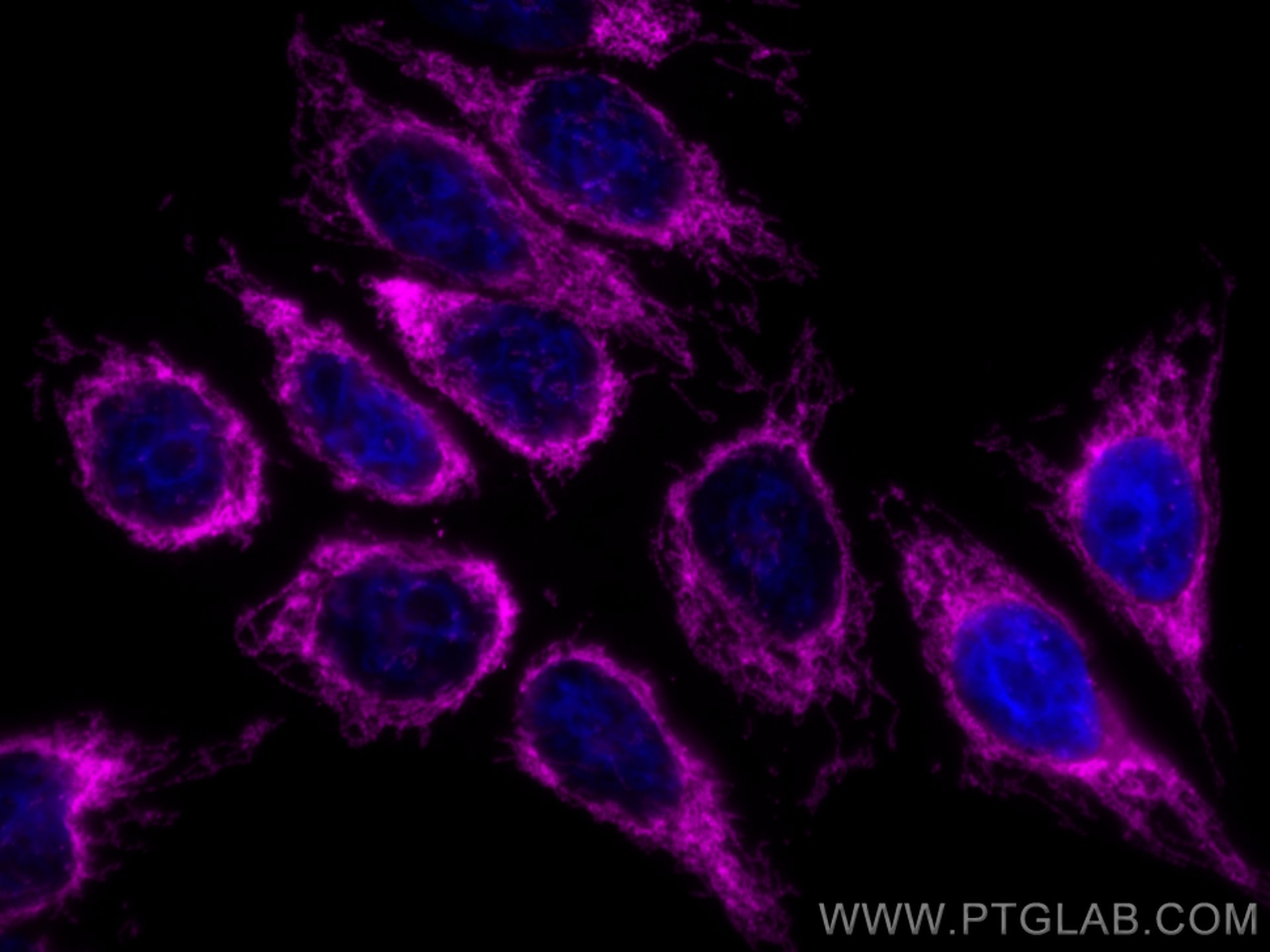 Immunofluorescence (IF) / fluorescent staining of HepG2 cells using CoraLite® Plus 647-conjugated TOM20 Polyclonal ant (CL647-11802)