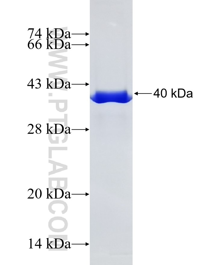 TOM20 fusion protein Ag2378 SDS-PAGE