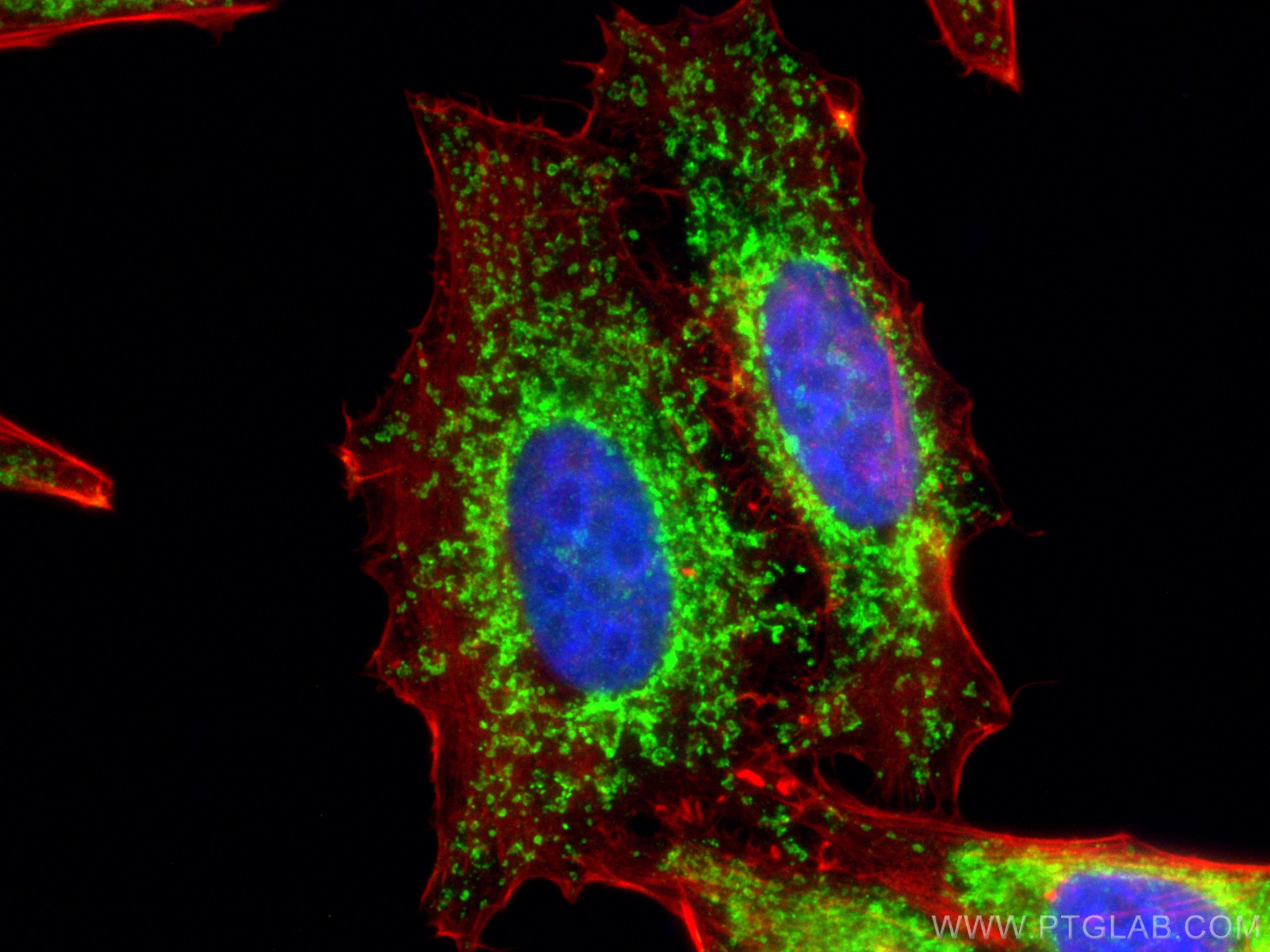 Immunofluorescence (IF) / fluorescent staining of HepG2 cells using TOM70 Polyclonal antibody (14528-1-AP)