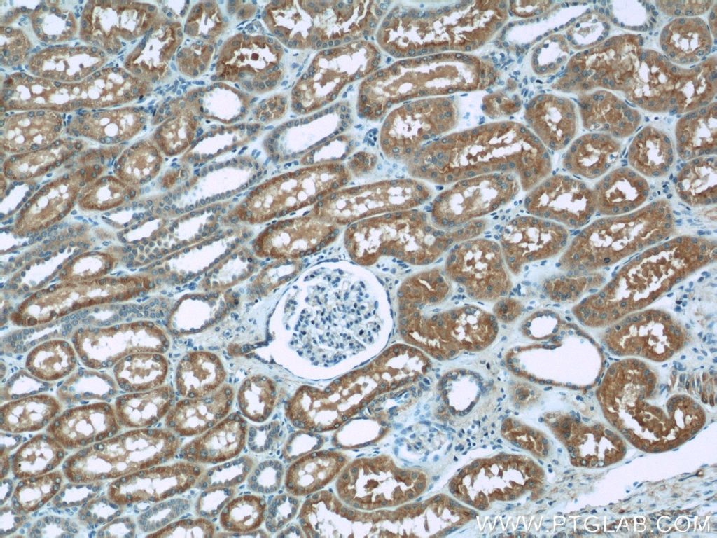 Immunohistochemistry (IHC) staining of human kidney tissue using TOM70 Polyclonal antibody (14528-1-AP)