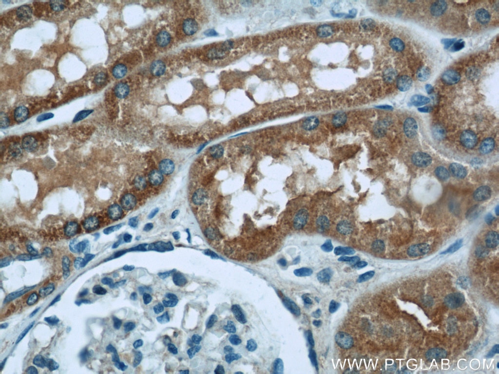 Immunohistochemistry (IHC) staining of human kidney tissue using TOM70 Polyclonal antibody (14528-1-AP)