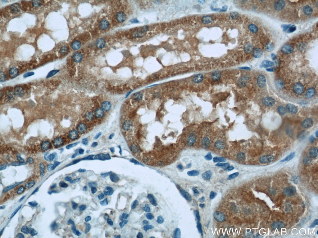 IHC staining of human kidney using 14528-1-AP