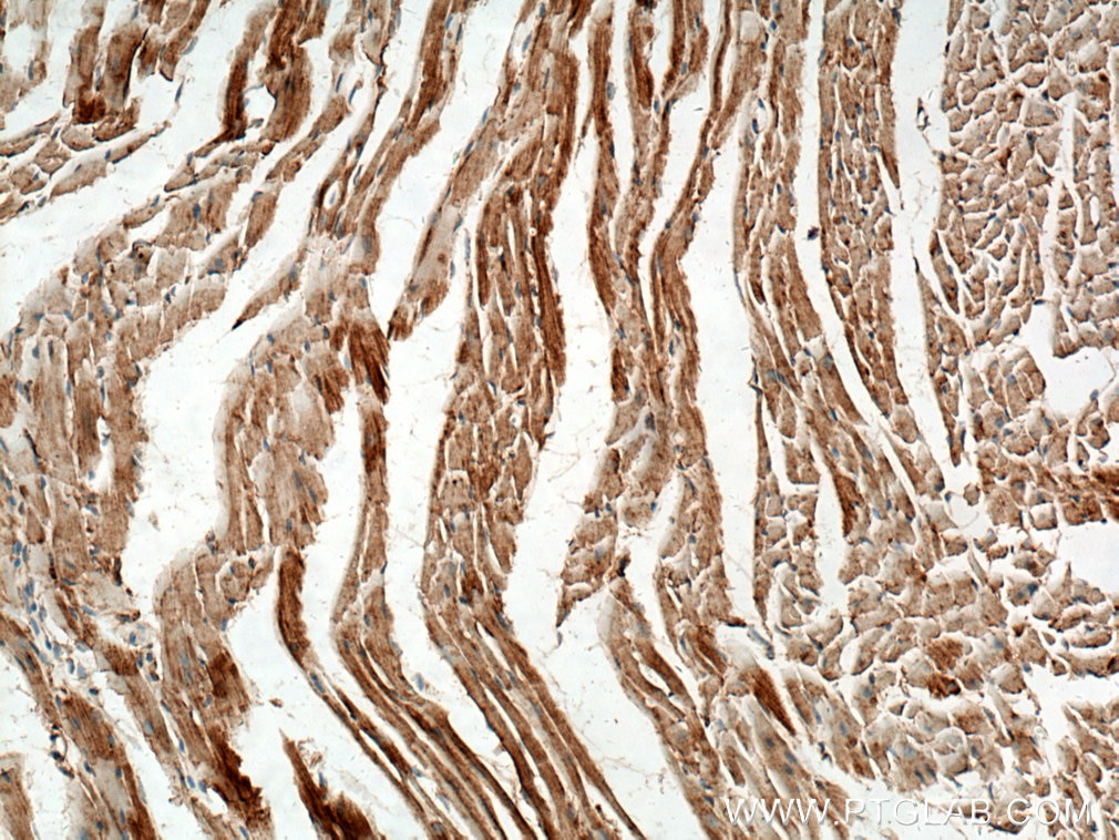 Immunohistochemical analysis of paraffin-embedded mouse heart tissue slide using 14528-1-AP (TOM70 antibody) at dilution of 1:400 (under 10x lens. Heat mediated antigen retrieval with Tris-EDTA buffer (pH 9.0). Immunohistochemistry (IHC) staining of mouse heart tissue using TOM70 Polyclonal antibody (14528-1-AP)