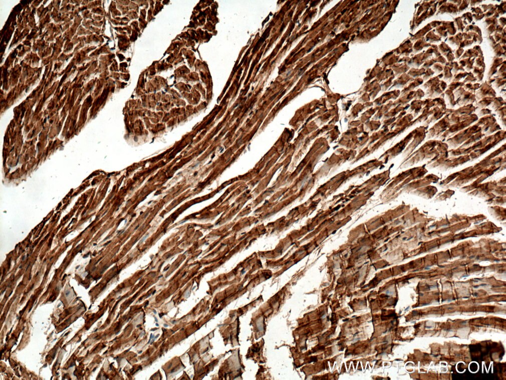 IHC staining of mouse heart using 14528-1-AP