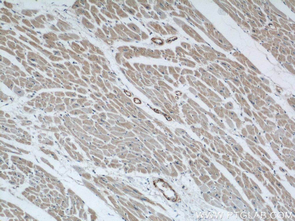 Immunohistochemistry (IHC) staining of human heart tissue using TOM70 Polyclonal antibody (14528-1-AP)