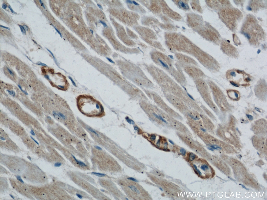 Immunohistochemistry (IHC) staining of human heart tissue using TOM70 Polyclonal antibody (14528-1-AP)