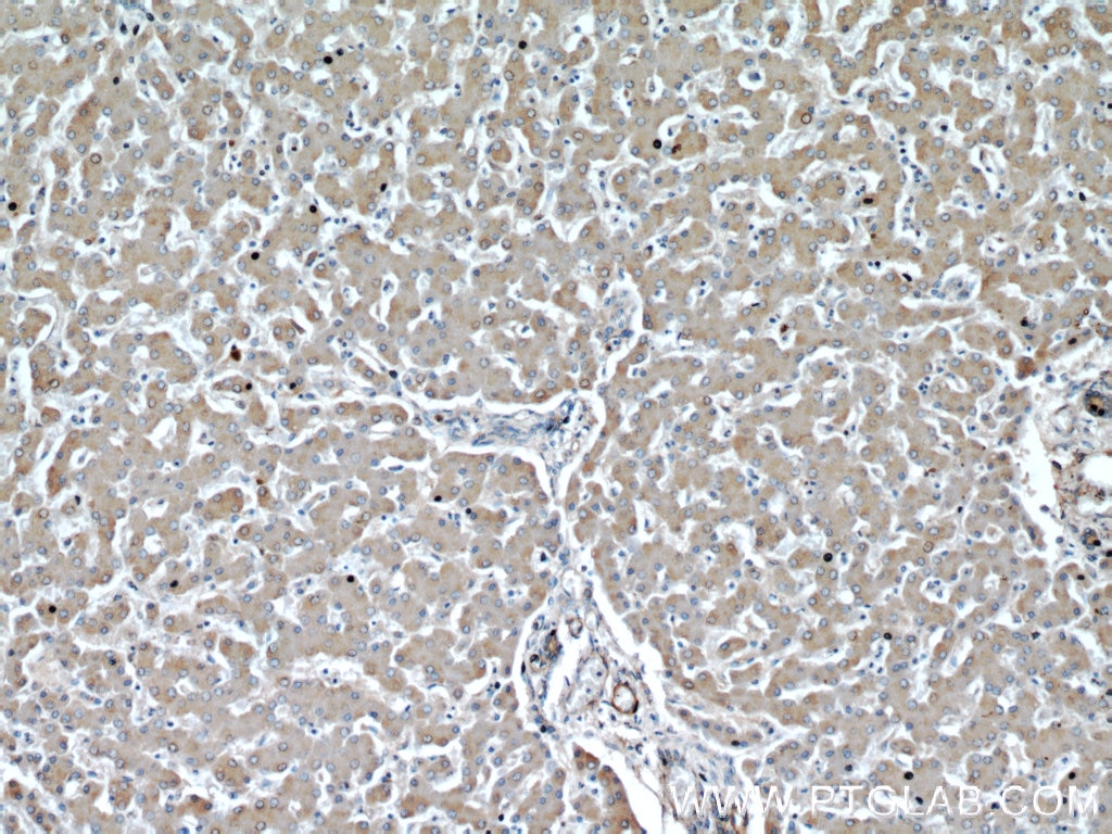 Immunohistochemistry (IHC) staining of human liver tissue using TOM70 Polyclonal antibody (14528-1-AP)