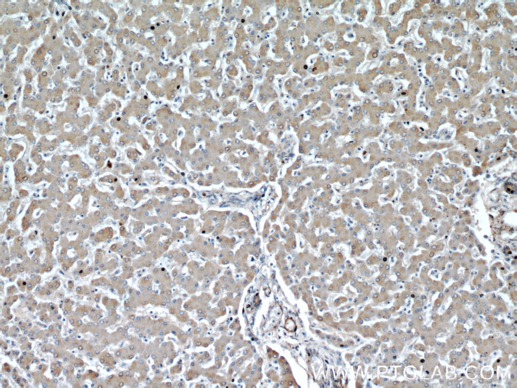 IHC staining of human liver using 14528-1-AP