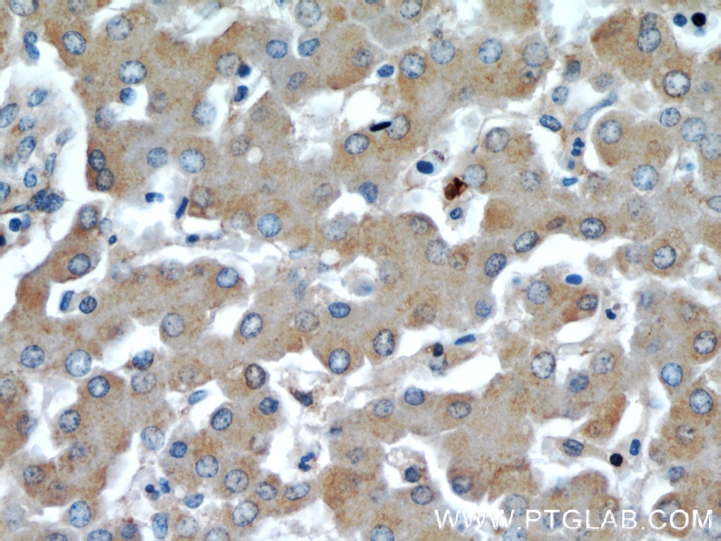 Immunohistochemistry (IHC) staining of human liver tissue using TOM70 Polyclonal antibody (14528-1-AP)