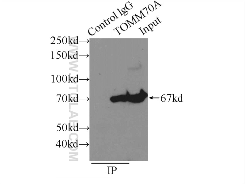 Immunoprecipitation (IP) experiment of mouse brain tissue using TOM70 Polyclonal antibody (14528-1-AP)