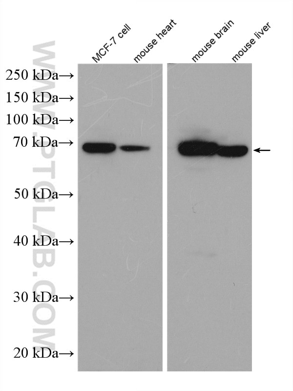 Western Blot (WB) analysis of MCF-7 cells using TOM70 Polyclonal antibody (14528-1-AP)