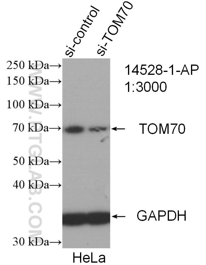 Western Blot (WB) analysis of HeLa cells using TOM70 Polyclonal antibody (14528-1-AP)