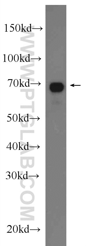 Western Blot (WB) analysis of rat heart tissue using TOM70 Polyclonal antibody (14528-1-AP)