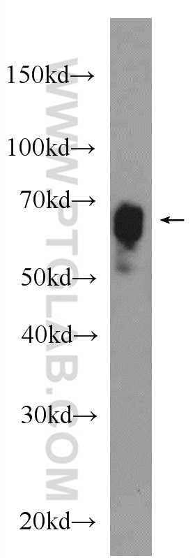 Western Blot (WB) analysis of rat skeletal muscle tissue using TOM70 Polyclonal antibody (14528-1-AP)