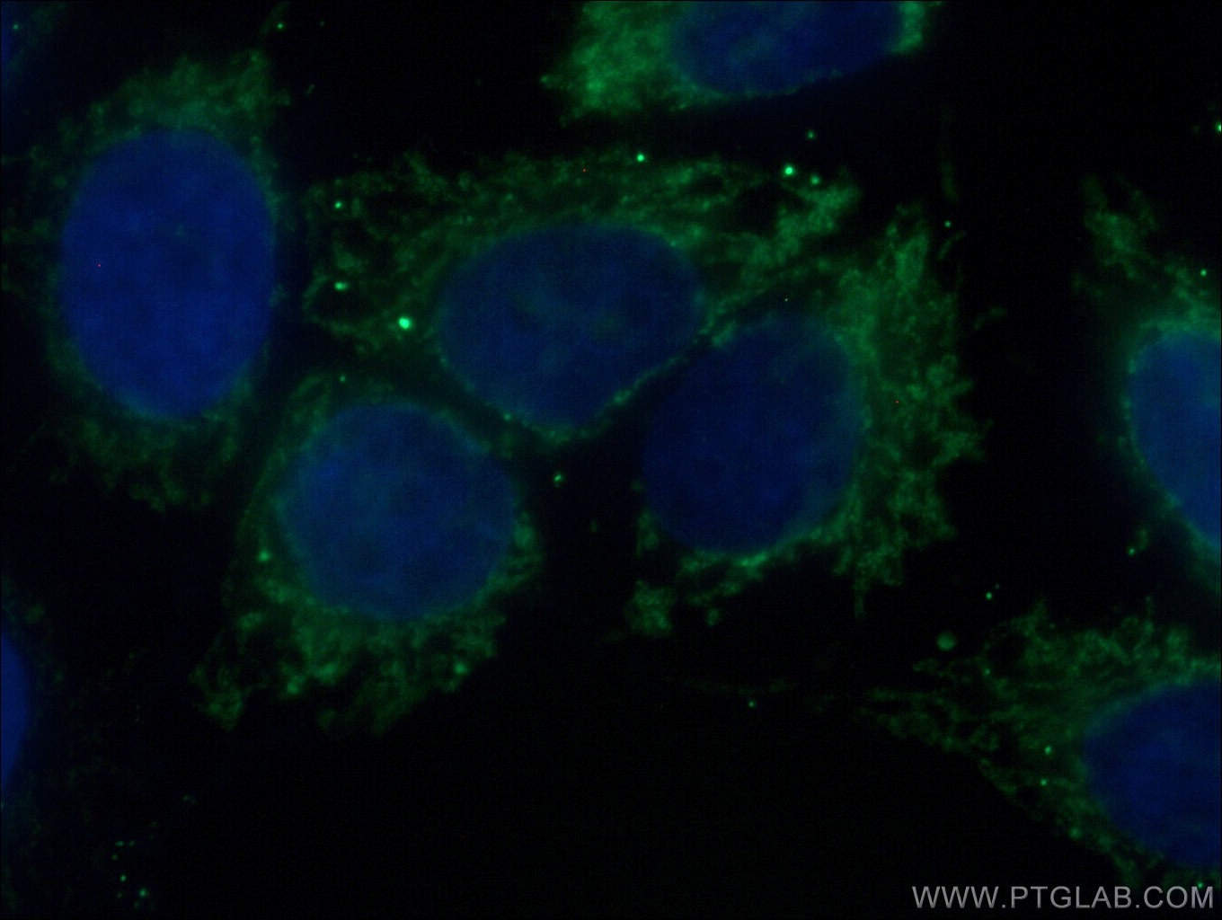 Immunofluorescence (IF) / fluorescent staining of HeLa cells using TOM70 Monoclonal antibody (66593-1-Ig)