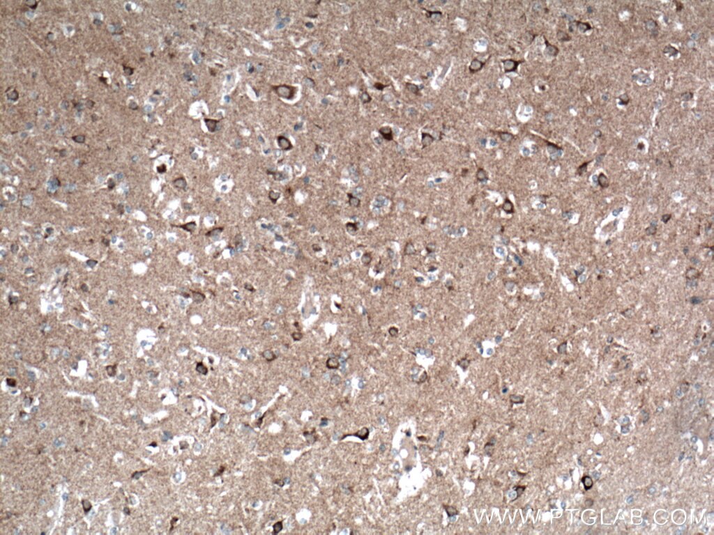 Immunohistochemistry (IHC) staining of human brain tissue using TOM70 Monoclonal antibody (66593-1-Ig)