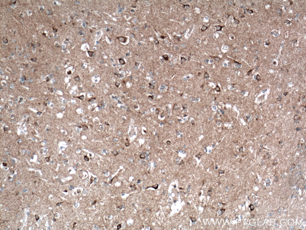 IHC staining of human brain using 66593-1-Ig