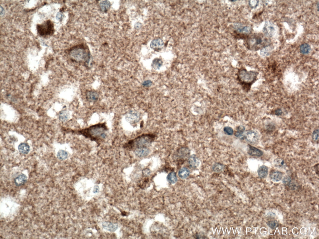 Immunohistochemistry (IHC) staining of human brain tissue using TOM70 Monoclonal antibody (66593-1-Ig)